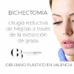 Bola de Bichat Valencia · Bichectomía con el Dr. Giovanni